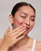 Model rubbing aeco into face 