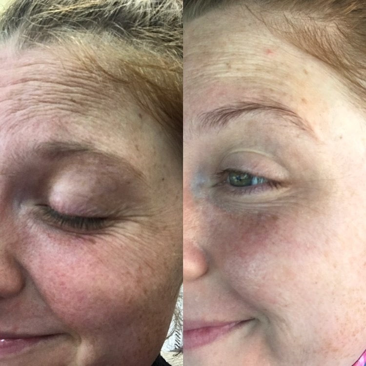Before and After Person Using MARA Algae Retinol Face Oil