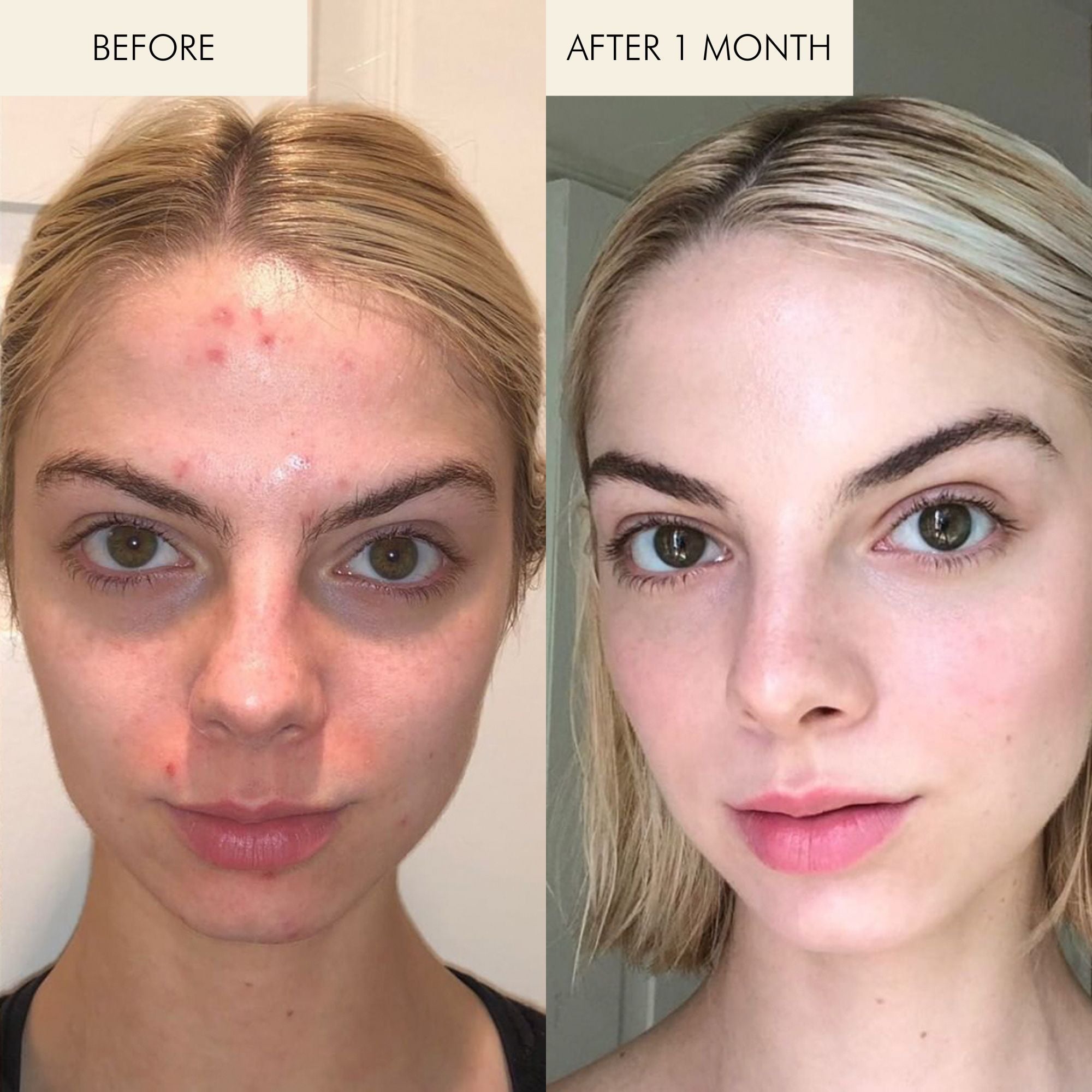 Algae Retinol Face Oil Before and After