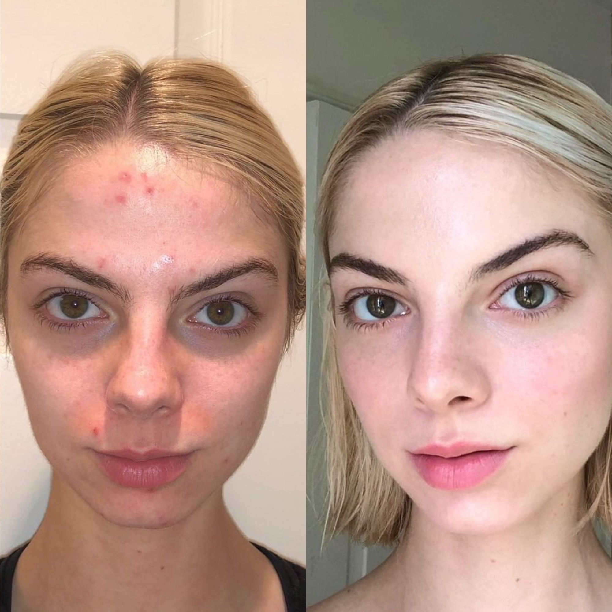 Before and After using MARA Algae Retinol Face Oil