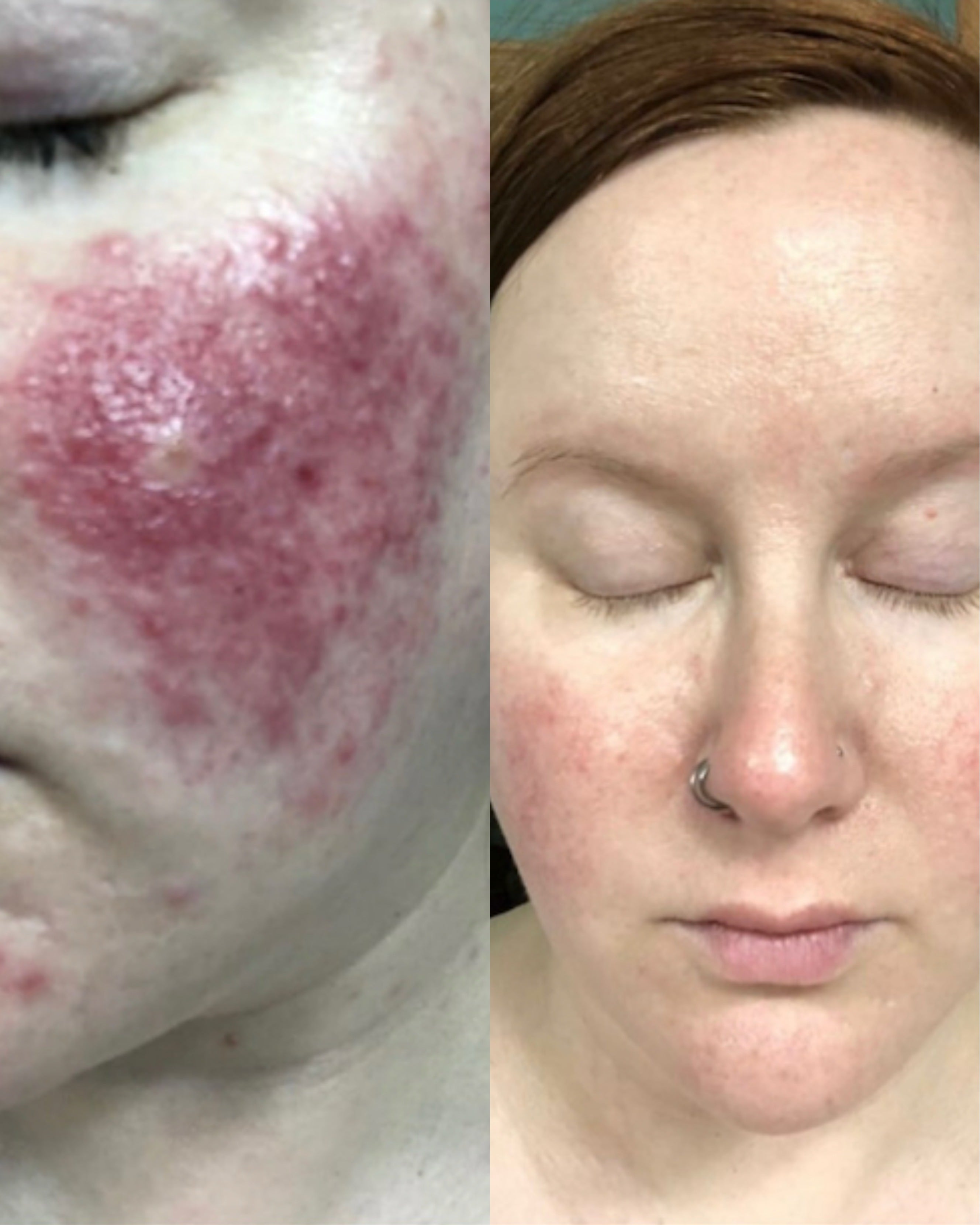 Before and after Algae Retinol Fac Oil comparison