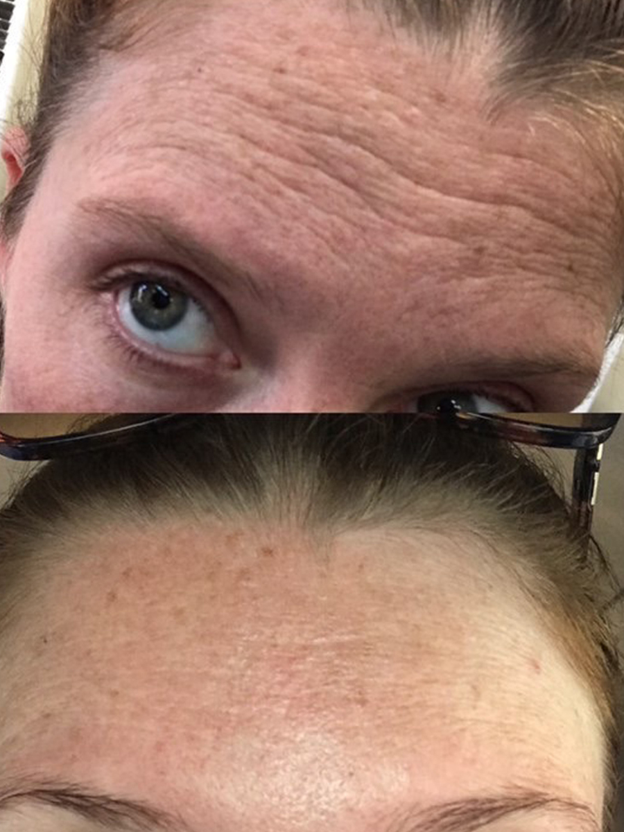 before and after Algae Retinol Face Oil 