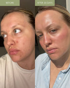 MARA Clear Skin Mineral Milk Before and After