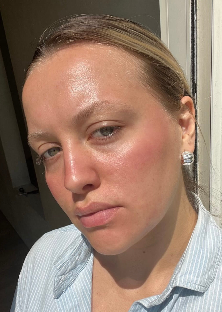 Woman wearing a light blue striped shirt outdoors after Clear Skin Mineral Milk