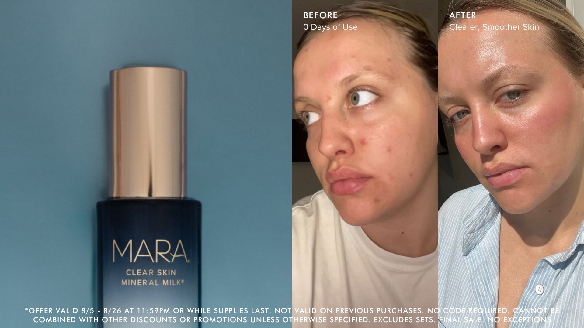 MARA Clear Skin Mineral Milk bottle on a blue background with a side-by-side comparison of a woman's face before and after use