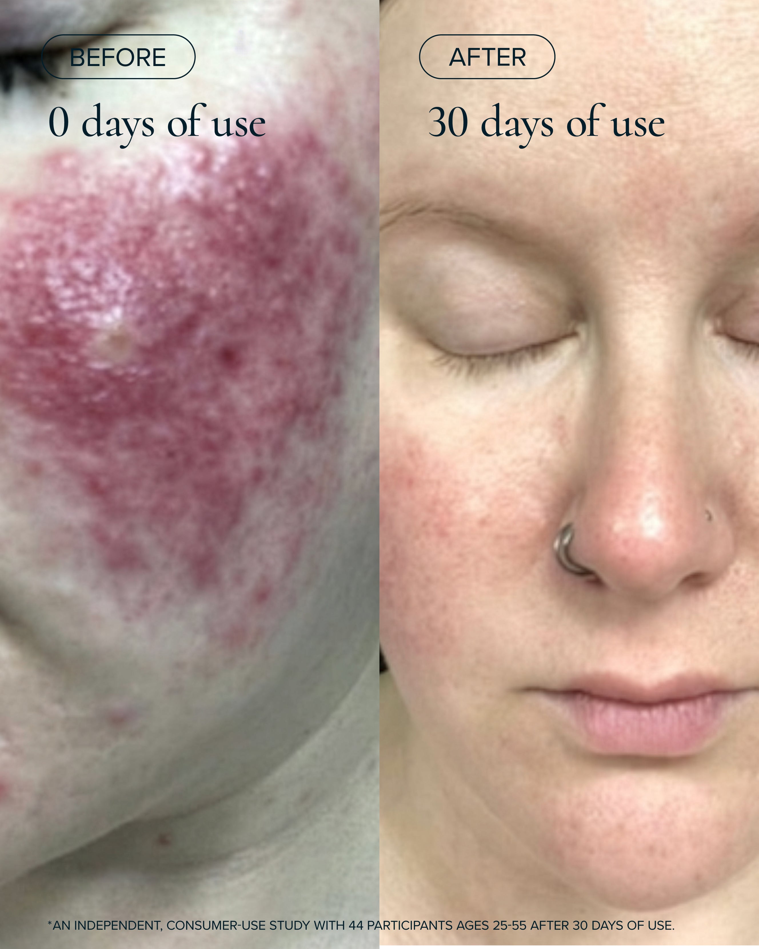 before and after of using algae retinol face oil 