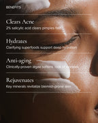 Benefits of MARA Clear Skin Mineral Milk