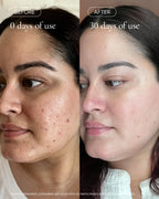 Before and after using MARA Clear Skin Mineral Milk