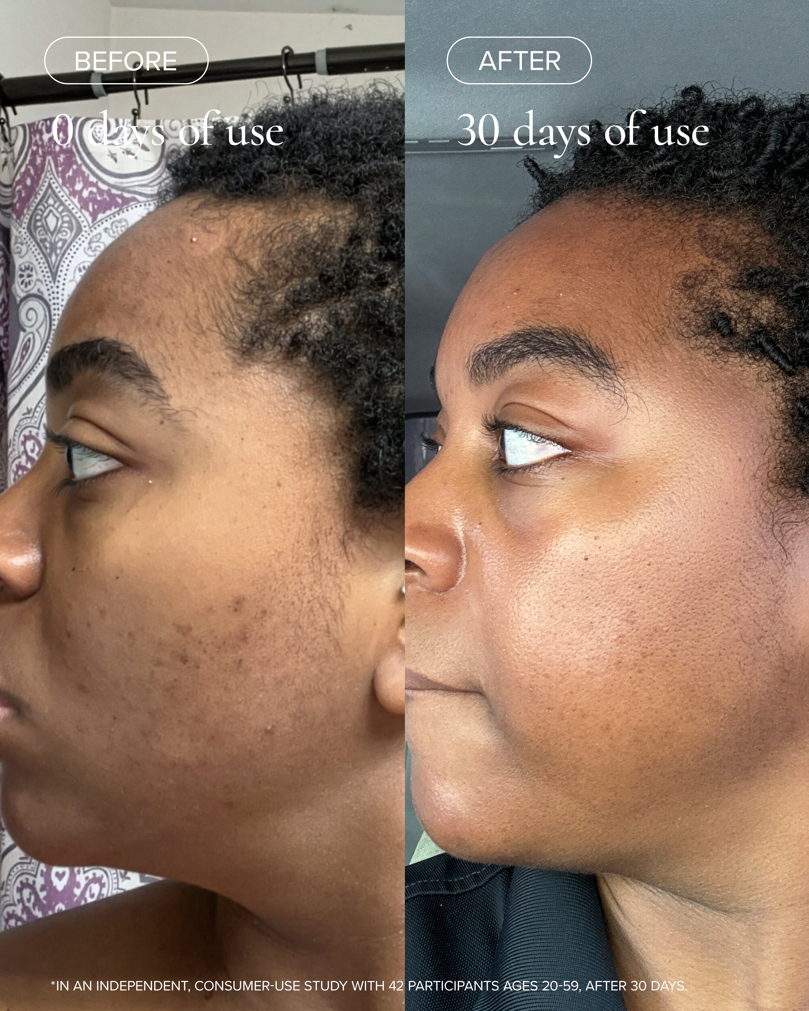 Before and after using MARA Clear Skin Mineral Milk