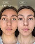 Before and after using MARA Volcanic Sea Clay Detox Masque 