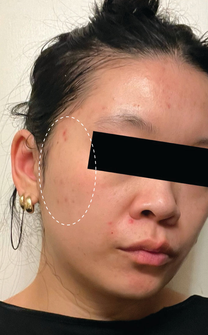 Person after using Aura Cleanse Foaming Gel Cleanser