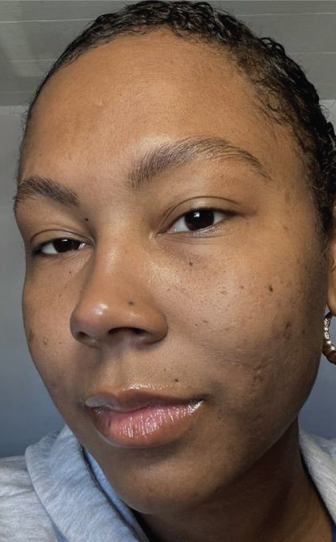 Close-up of a person before Pearl Peptide Glaze